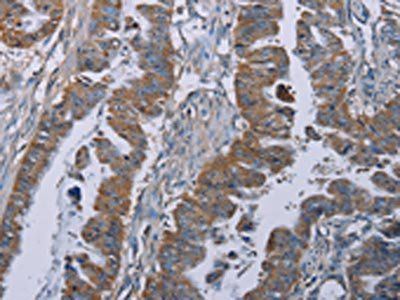 BMP3 Antibody