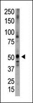 Bmp5 antibody