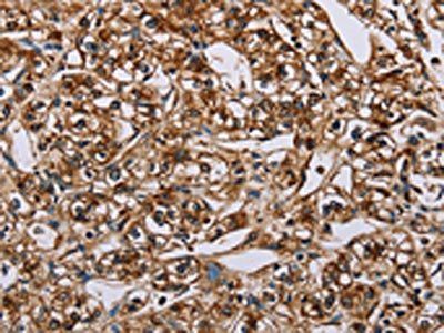 BMP6 Antibody