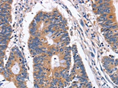 BMP6 Antibody