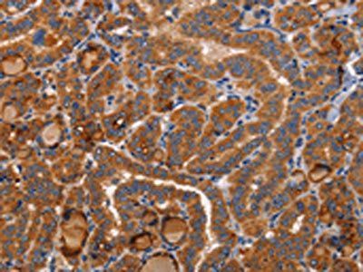 BMP6 antibody