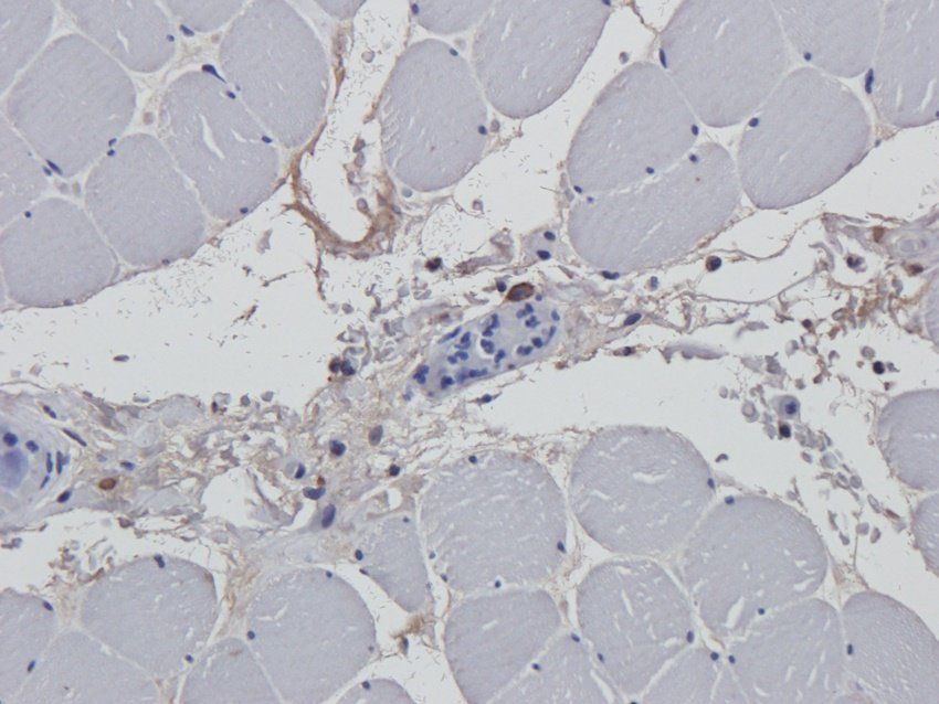 BMR1A antibody