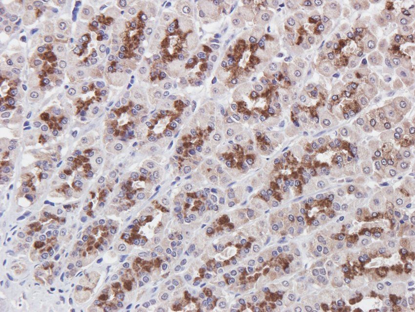 BMR1A antibody