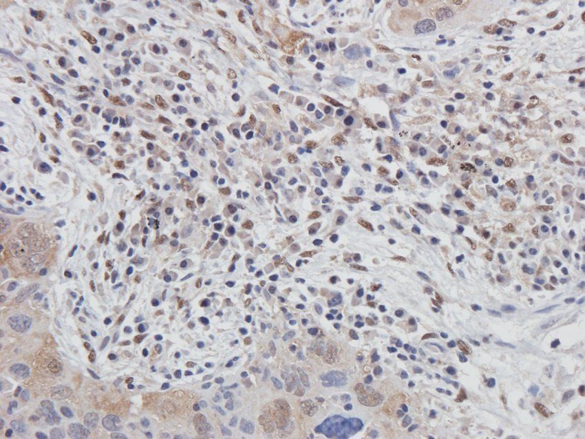 BMR1A antibody