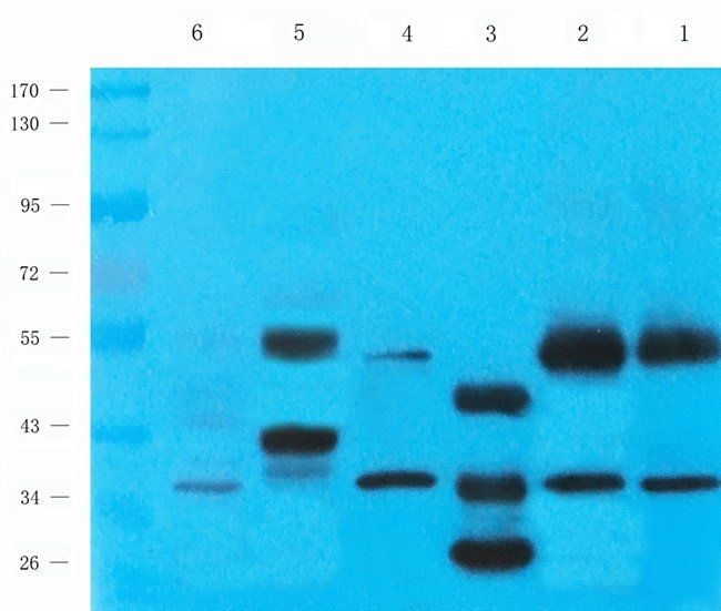 BMR1A antibody