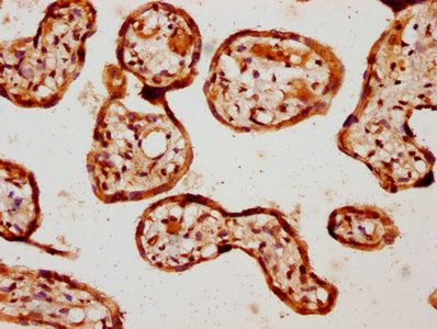 BMPR1A Antibody