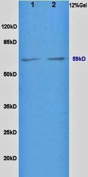 BMPR1A antibody