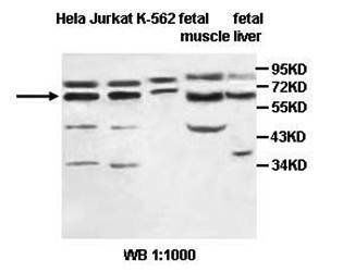 BMPR1A antibody