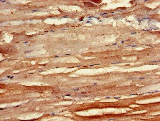BMPR1B Antibody