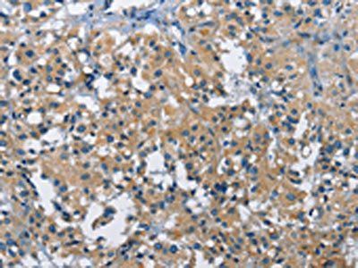 BMPR1B Antibody