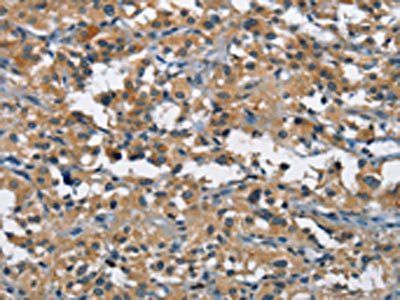 BMPR1B Antibody