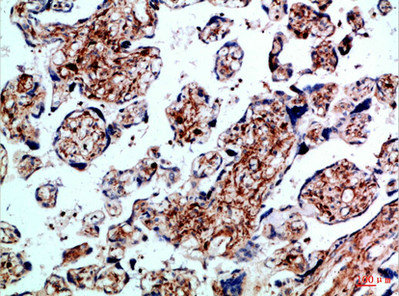 BMPR1B antibody