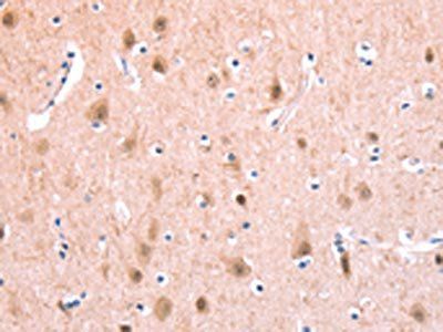 BMPR2 Antibody