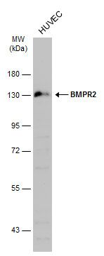 Perforin antibody