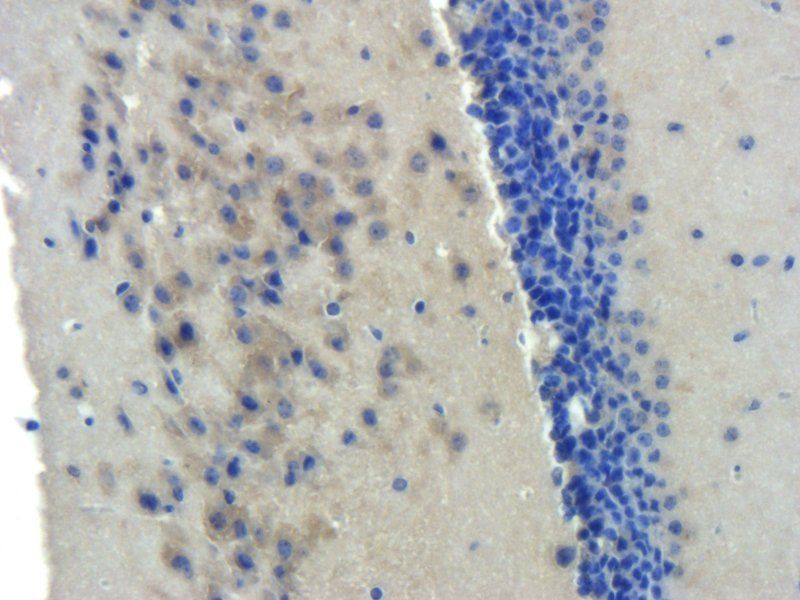 BMPR2 antibody