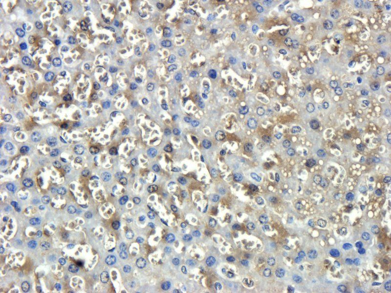 BMPR2 antibody