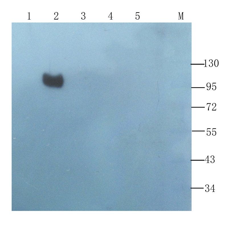 BMPR2 antibody