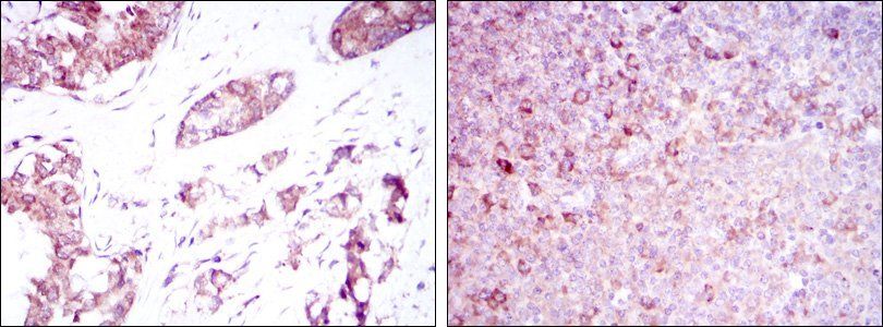 BMPR2 Antibody
