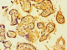BMX Antibody