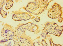 BMX Antibody