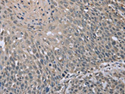 BMX Antibody