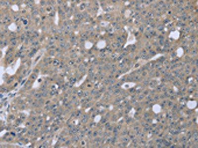 BMX Antibody