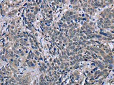 BMX Antibody