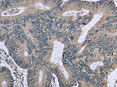 BMX Antibody