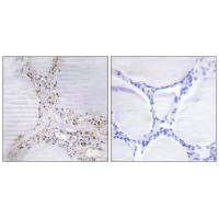 BMX Antibody