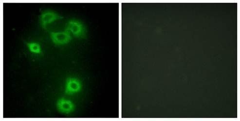 BMX Antibody