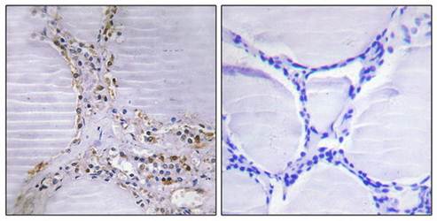 BMX Antibody