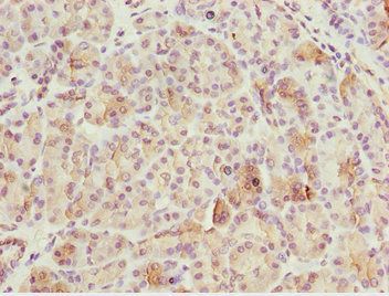 BNIP1 Antibody