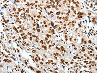BNIP1 Antibody