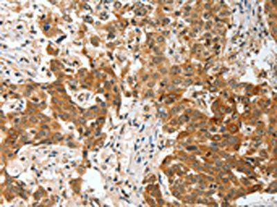 BNIP1 Antibody