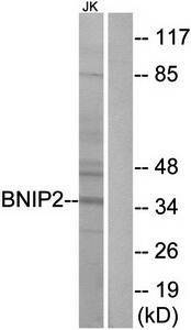 BNIP2 Antibody
