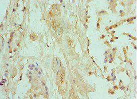 BNIP3 Antibody