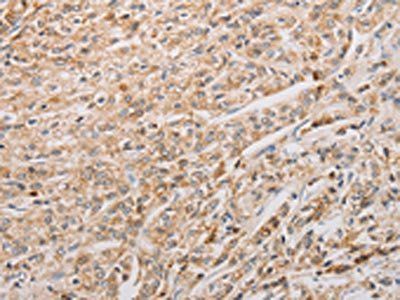 BNIP3 Antibody