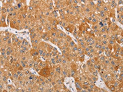 BNIP3 Antibody
