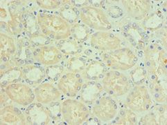 BNIP3L Antibody