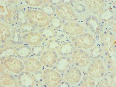 BNIP3L antibody