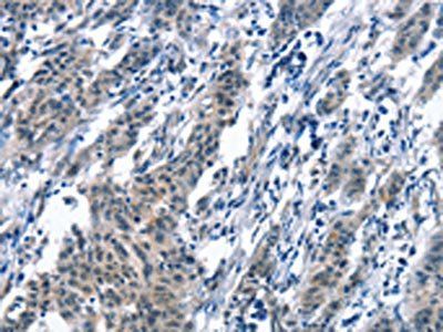 BNIP3L Antibody