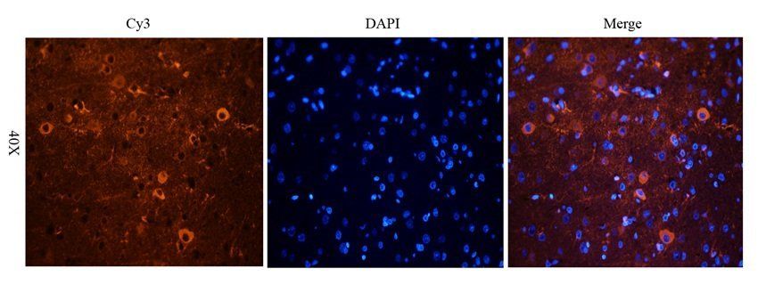 BNP antibody