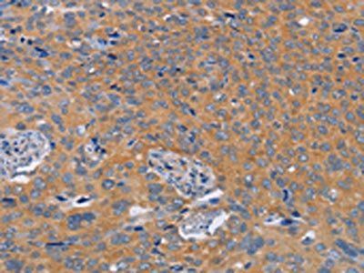 BOD1 Antibody