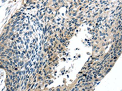 BOK Antibody