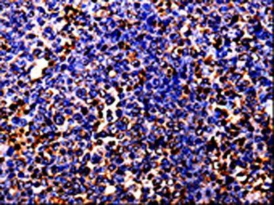 BOLL Antibody