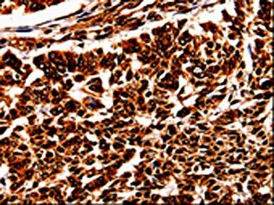 BOLL Antibody