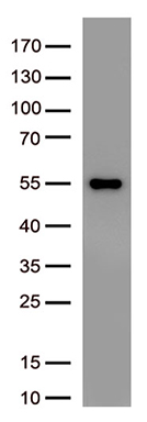 Bone marrow stromal cell antigen 1 (BST1) Mouse Monoclonal Antibody