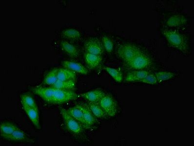 Bone morphogenetic protein 2 antibody