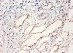 Bone morphogenetic protein 2 antibody