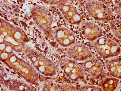 BMP2 Antibody